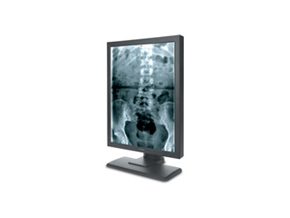 Медицинские монохромные мониторы